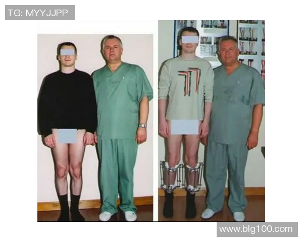 足球明星逆袭之路断骨增高手术背后的故事与启示 足球明星逆袭之路断骨增高手术背后的故事与启示